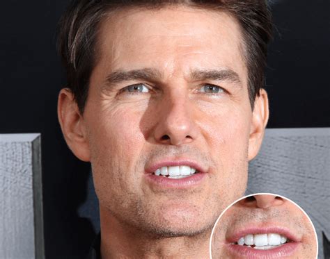 are tom cruise's teeth fake